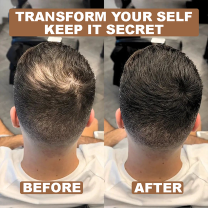 HoldTrue Scalp & Hair Concealer